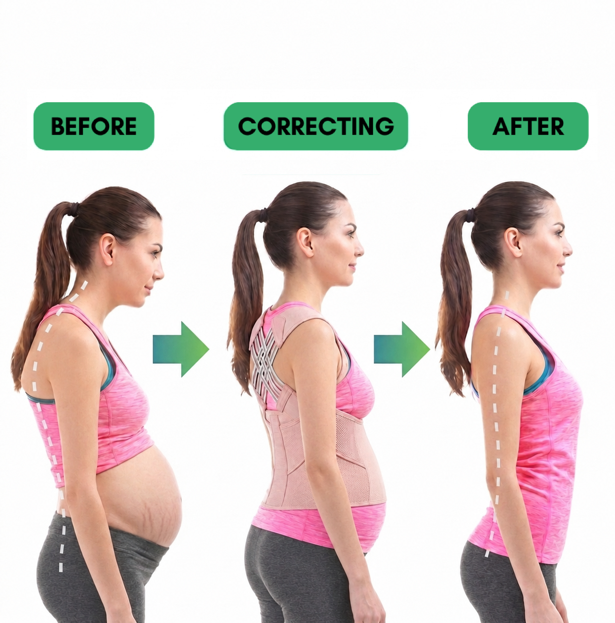 Vexlign Postpartum Posture Corrector