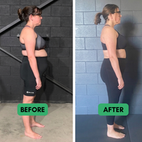 Vexlign Posture Corrector