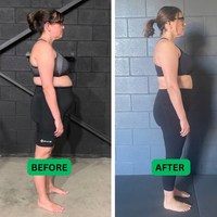 Vexlign Posture Corrector